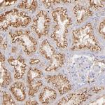 Kininogen 1 Polyclonal Antibody