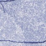 Kininogen 1 Antibody in Immunohistochemistry (Paraffin) (IHC (P))