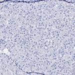 Kininogen 1 Antibody in Immunohistochemistry (Paraffin) (IHC (P))