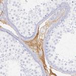 Kininogen 1 Antibody in Immunohistochemistry (Paraffin) (IHC (P))