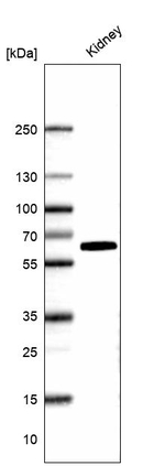 Kininogen 1 Antibody in Western Blot (WB)