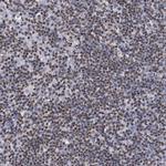 hnRNP A2B1 Polyclonal Antibody