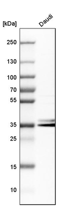 hnRNP A2B1 Antibody in Western Blot (WB)