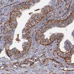 Vimentin Antibody in Immunohistochemistry (Paraffin) (IHC (P))