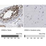 CREM Antibody