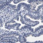 CREM Antibody in Immunohistochemistry (Paraffin) (IHC (P))