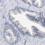 CREM Antibody in Immunohistochemistry (Paraffin) (IHC (P))