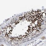 CREM Antibody in Immunohistochemistry (Paraffin) (IHC (P))