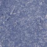 CREM Polyclonal Antibody