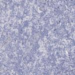 SNAP25 Polyclonal Antibody