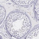 SNAP25 Antibody in Immunohistochemistry (Paraffin) (IHC (P))