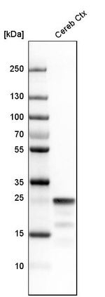 SNAP25 Antibody in Western Blot (WB)