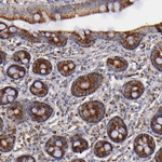 SHC Antibody in Immunohistochemistry (Paraffin) (IHC (P))