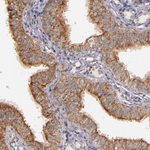 SHC Antibody in Immunohistochemistry (Paraffin) (IHC (P))
