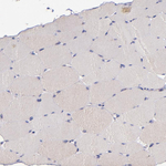 SHC Polyclonal Antibody