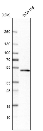 TRAF1 Antibody in Western Blot (WB)