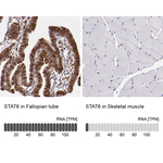 STAT6 Antibody in Immunohistochemistry (Paraffin) (IHC (P))