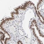 IRF9 Antibody in Immunohistochemistry (Paraffin) (IHC (P))