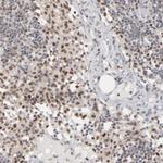 IRF9 Antibody in Immunohistochemistry (Paraffin) (IHC (P))