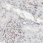 IRF9 Antibody in Immunohistochemistry (Paraffin) (IHC (P))