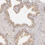 PKC delta Antibody in Immunohistochemistry (Paraffin) (IHC (P))