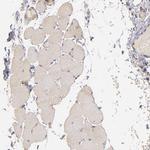 PKC delta Antibody in Immunohistochemistry (Paraffin) (IHC (P))