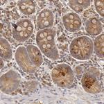 PKC delta Antibody in Immunohistochemistry (Paraffin) (IHC (P))