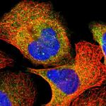 VAV1 Polyclonal Antibody