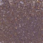 VAV1 Antibody in Immunohistochemistry (Paraffin) (IHC (P))