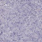 VAV1 Antibody in Immunohistochemistry (Paraffin) (IHC (P))