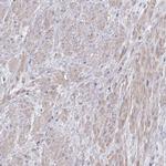 VAV1 Antibody in Immunohistochemistry (Paraffin) (IHC (P))
