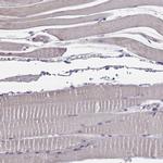 VAV1 Antibody in Immunohistochemistry (Paraffin) (IHC (P))