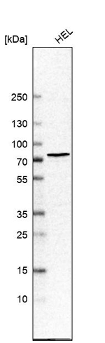 CHK2 Antibody in Western Blot (WB)