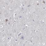 LRG1 Antibody in Immunohistochemistry (Paraffin) (IHC (P))