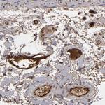 LRG1 Antibody in Immunohistochemistry (Paraffin) (IHC (P))
