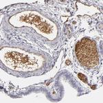 LRG1 Antibody in Immunohistochemistry (Paraffin) (IHC (P))