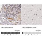 LRG1 Antibody