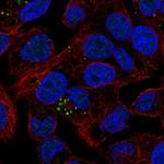 LRG1 Antibody in Immunocytochemistry (ICC/IF)