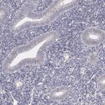 LRG1 Antibody in Immunohistochemistry (Paraffin) (IHC (P))