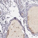 LRG1 Antibody in Immunohistochemistry (Paraffin) (IHC (P))