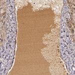 LRG1 Antibody in Immunohistochemistry (Paraffin) (IHC (P))