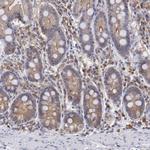 PKC delta Antibody in Immunohistochemistry (Paraffin) (IHC (P))