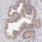 PKC delta Antibody in Immunohistochemistry (Paraffin) (IHC (P))