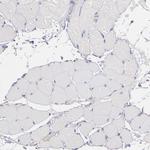 PKC delta Antibody in Immunohistochemistry (Paraffin) (IHC (P))