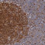 PKC delta Antibody in Immunohistochemistry (Paraffin) (IHC (P))