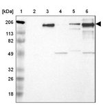 Laminin beta-2 Antibody in Western Blot (WB)