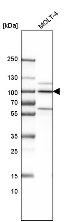 ILF3 Antibody in Western Blot (WB)