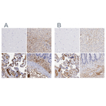 FIBB Antibody in Immunohistochemistry (Paraffin) (IHC (P))