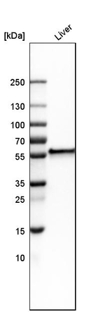 FIBB Antibody in Western Blot (WB)