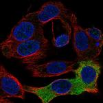 FIBB Polyclonal Antibody